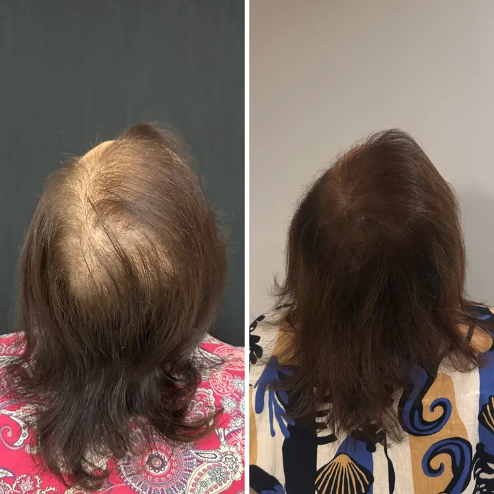 Resultado de tratamento capilar 8 — antes e depois