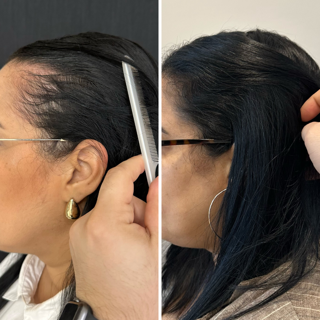 Resultado de tratamento capilar 12 — antes e depois