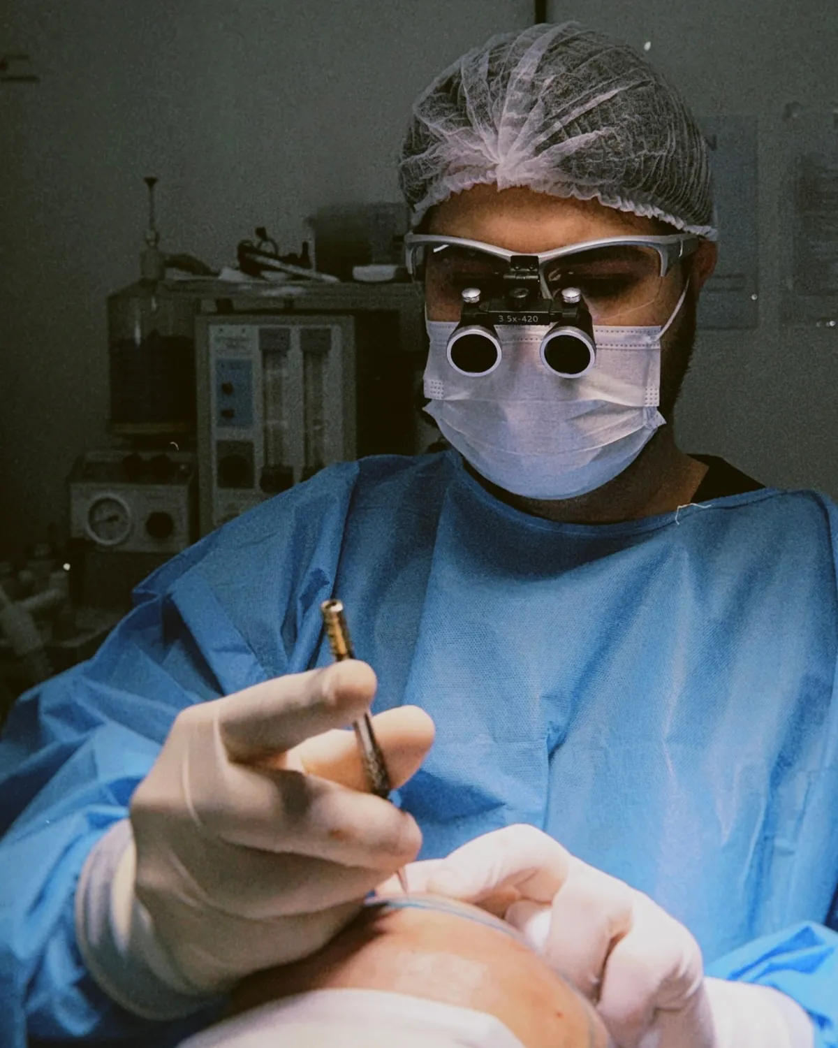 Dr. Éric Aguiar realizando transplante capilar FUE com lupa cirúrgica