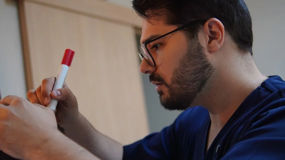 Dr. Éric Aguiar marcando a linha frontal no planejamento do transplante capilar